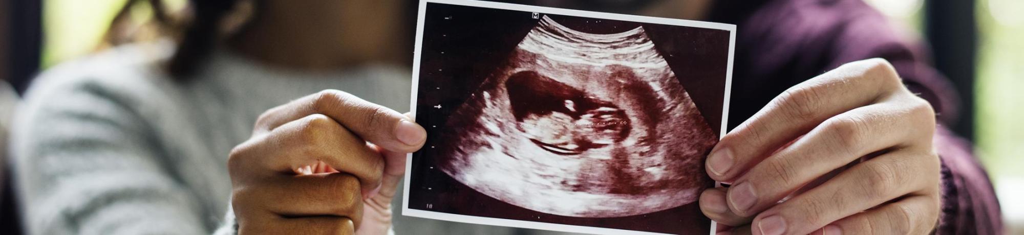 Parents with Ultrasound image